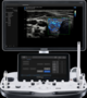 Аппарат УЗИ Samsung Medison RS85 доступен на сайте  фото - 3